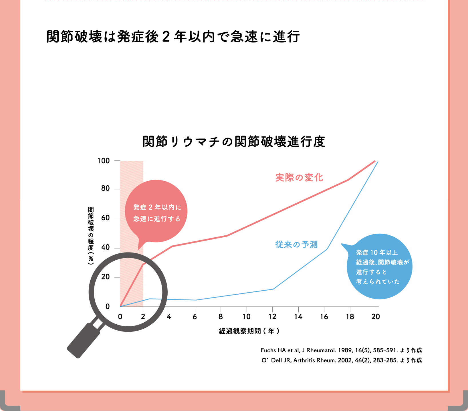 関節破壊は発症後2年以内で急速に進行
