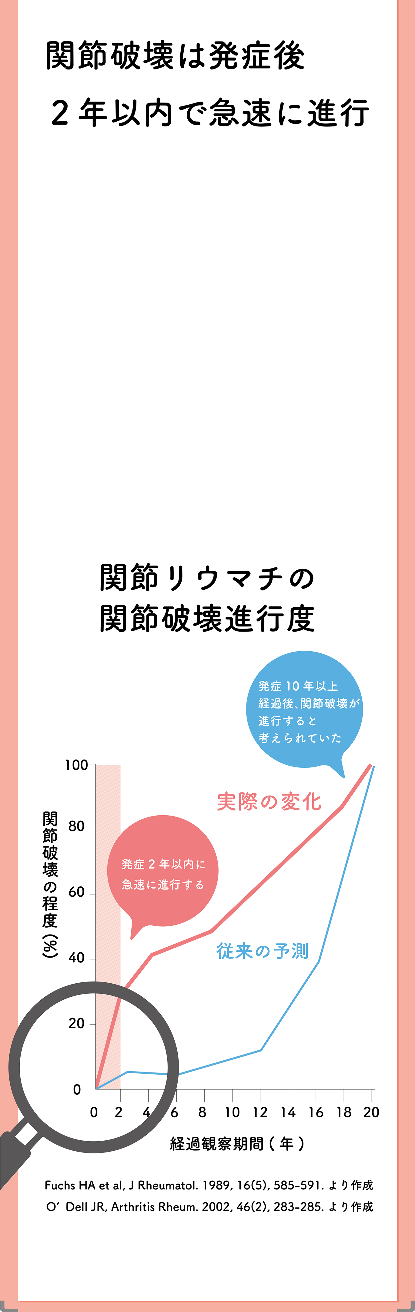 関節破壊は発症後2年以内で急速に進行